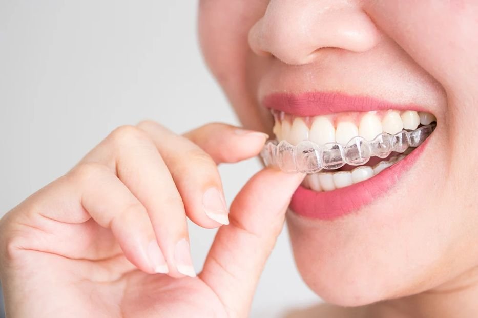 11 Ways to Make Most of Invisalign Treatment