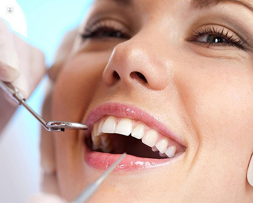 Dental Implants Tampa