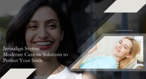Invisalign System Moderate