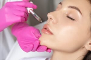 Lip Filler Aftercare How to Keep Your Lips Looking Great