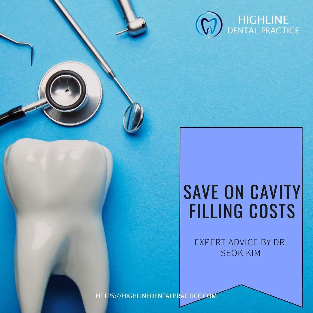 Veneers vs Cavity Filling Costs