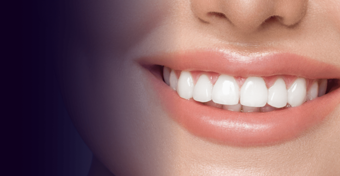 Say Goodbye to Stains Discover Teeth Whitening in Dubai