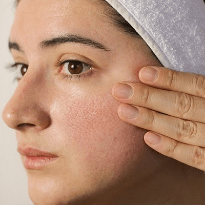 Effective Solutions for Reducing Large Pores