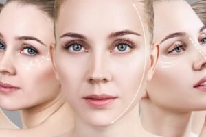 Expect from a Liquid Facelift Procedure