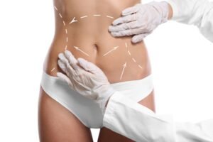 Experience Precision Fat Removal with Body Jet Liposuction