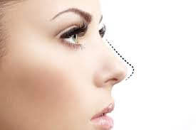 Rhinoplasty Can Improve Your Confidence and Appearance