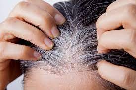 White Hair Removal in Dubai-Abu Dhabi |