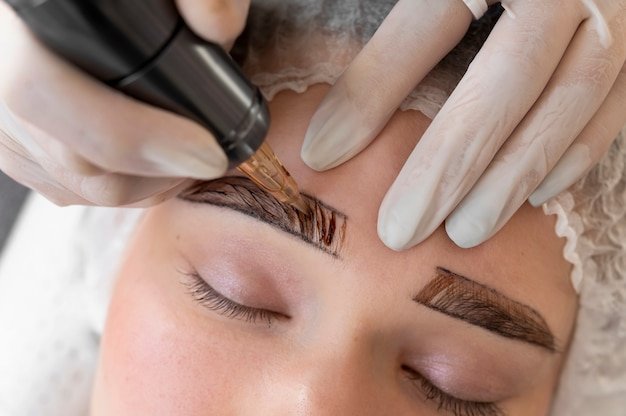 Brow Lift Surgery: The Best Solution for Drooping Eyebrows