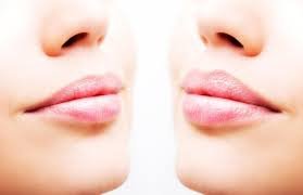 Bullhorn Lip Lift: How to Get Beautiful Lips Without Filler