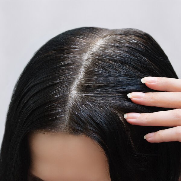 Effective White Hair Removal Solutions in Dubai