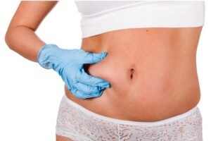 Lipo Abdominoplasty: Solution for a Contoured Midsection