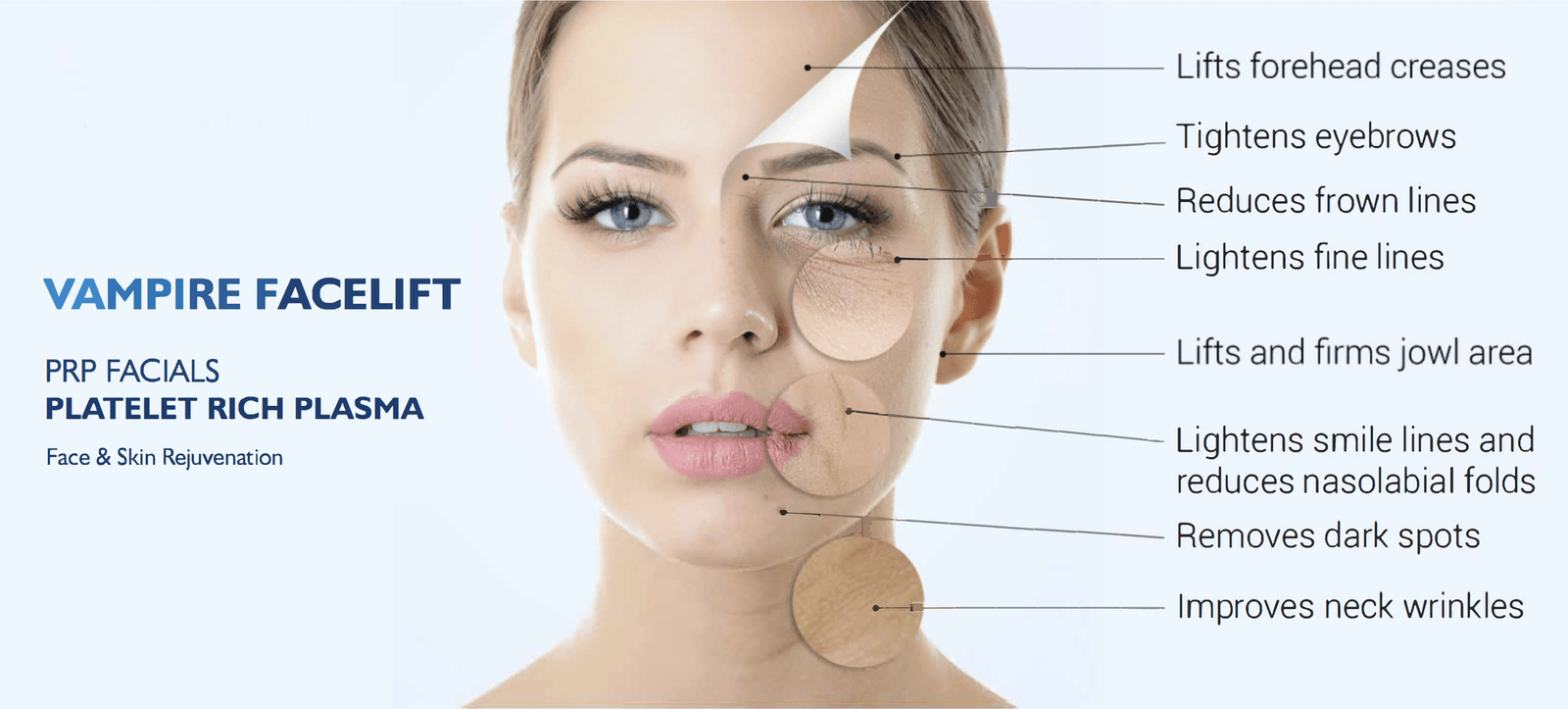 Vampire Facelift: A Revolutionary Anti-Aging Treatment