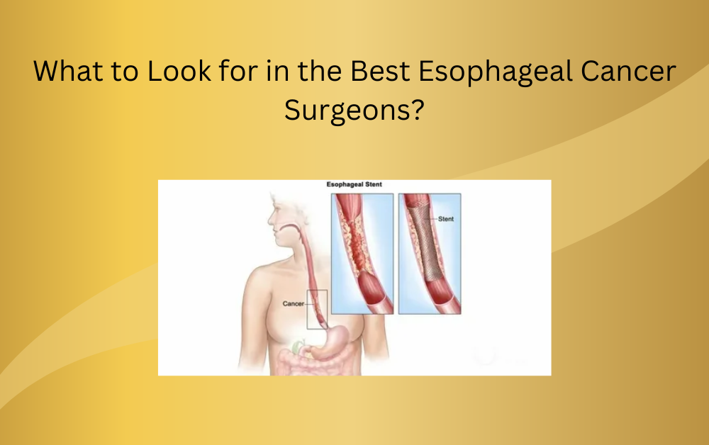 esophageal cancer surgeons in Dubai