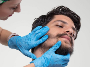 Beard Hair Transplant in Dubai