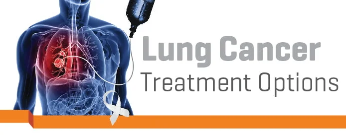 Is There A Best Treatment Option For Lung Cancer