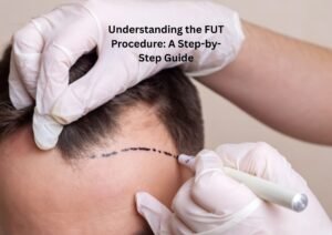 Understanding the FUT Procedure: A Step-by-Step Guide