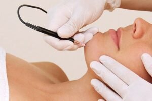 Electrolysis Hair Removal Cost: Choose for Permanent Results