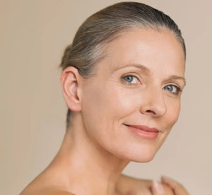 Fine Lines and Wrinkles on the Forehead in Dubai