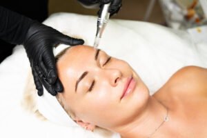 How to Prepare for a Plasma Pen Treatment Session