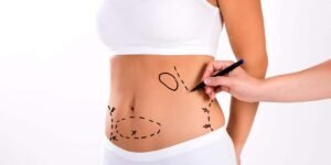 Laser Liposuction in Dubai