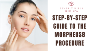 Morpheus8 procedure