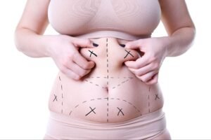 Non-Surgical vs Surgical Liposuction