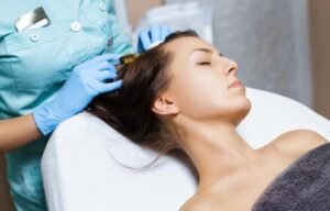 What Are the Costs of Stem Cell Hair Transplant