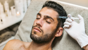 What Are the Key Benefits of Profhilo Treatment for Men?