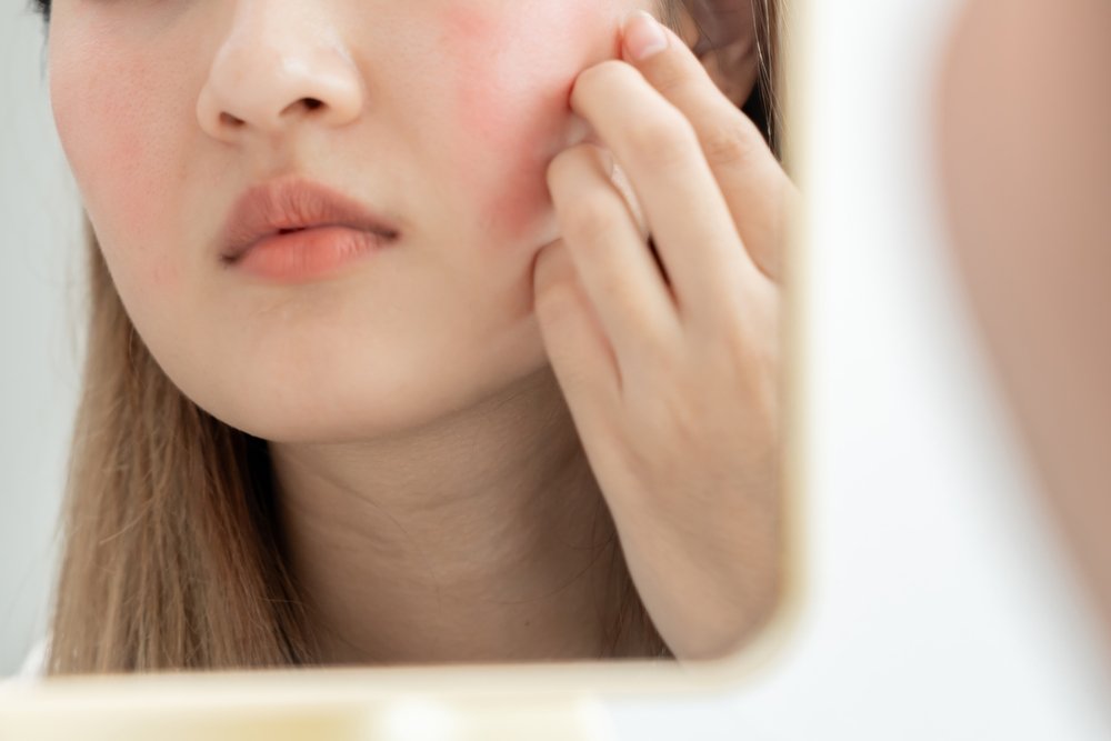 Dermatology Billing Services