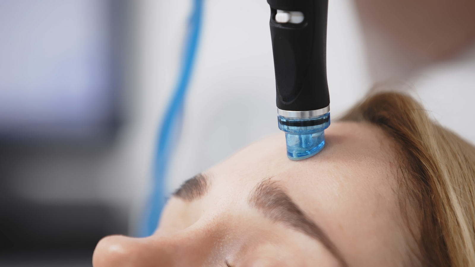 Botox Injections for Excessive Sweating Relief