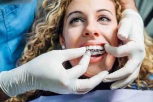 dental implants Blackburn