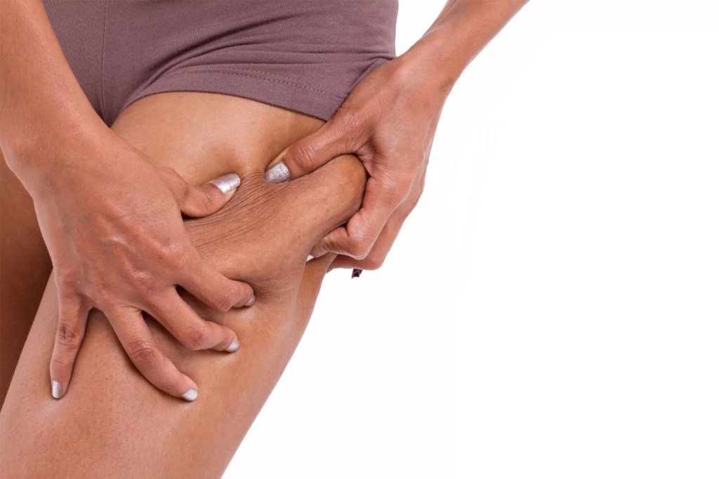 Cellulite Removal for Men: Breaking the Stigma