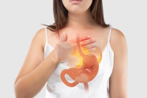 How to Manage Gastroesophageal Reflux Naturally