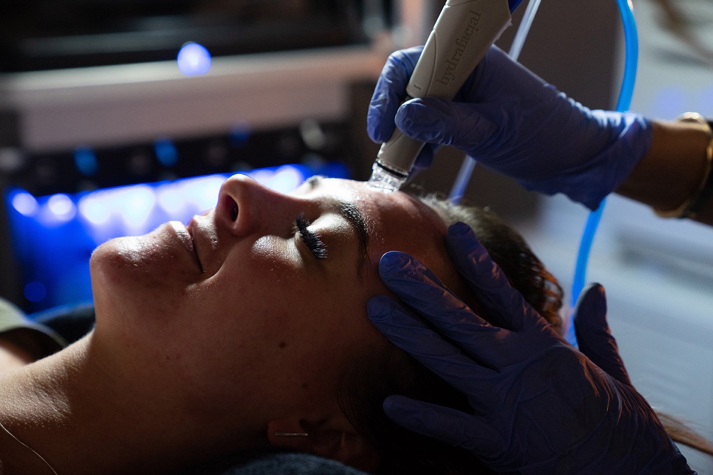 HydraFacial Cost and What You Get for It