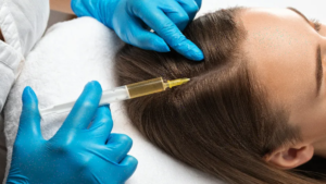 Is PRP Treatment Better Than Hair Transplant?