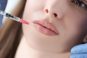 Lip Fillers Natural-Looking Results or Overdone Lips