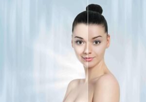 Skin Whitening Peels: What to Expect Afterward