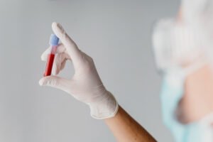 nurse holding with blood tube