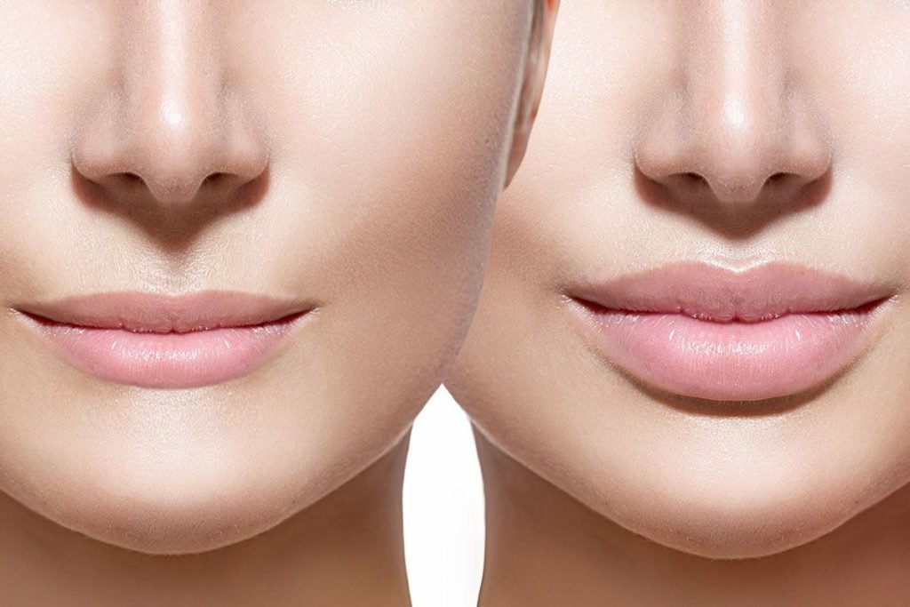 Benefits of Cheek Augmentation for Aging Skin