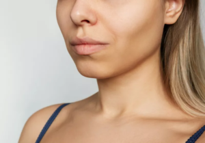 Buccal Fat Removal for Long-Term Facial Harmony