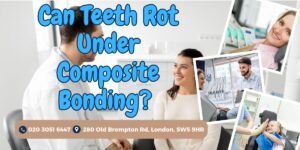 composite bonding full set