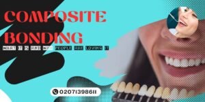 composite bonding in London
