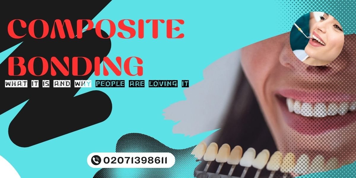 composite bonding in London