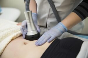 Does Laser Lipolysis Treatment Tighten Skin After Fat Removal
