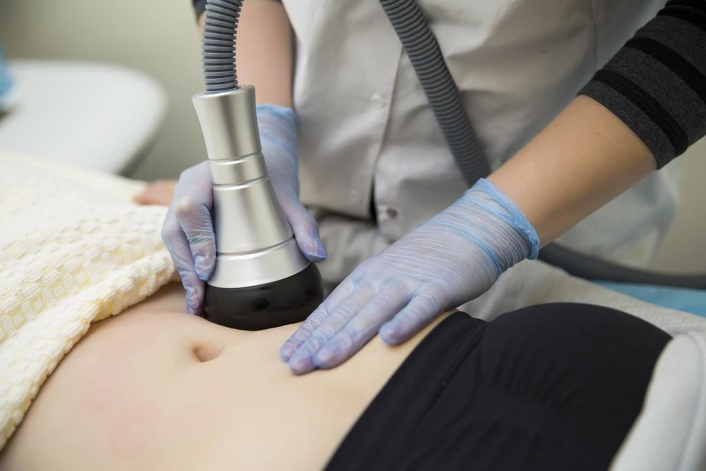 Does Laser Lipolysis Treatment Tighten Skin After Fat Removal
