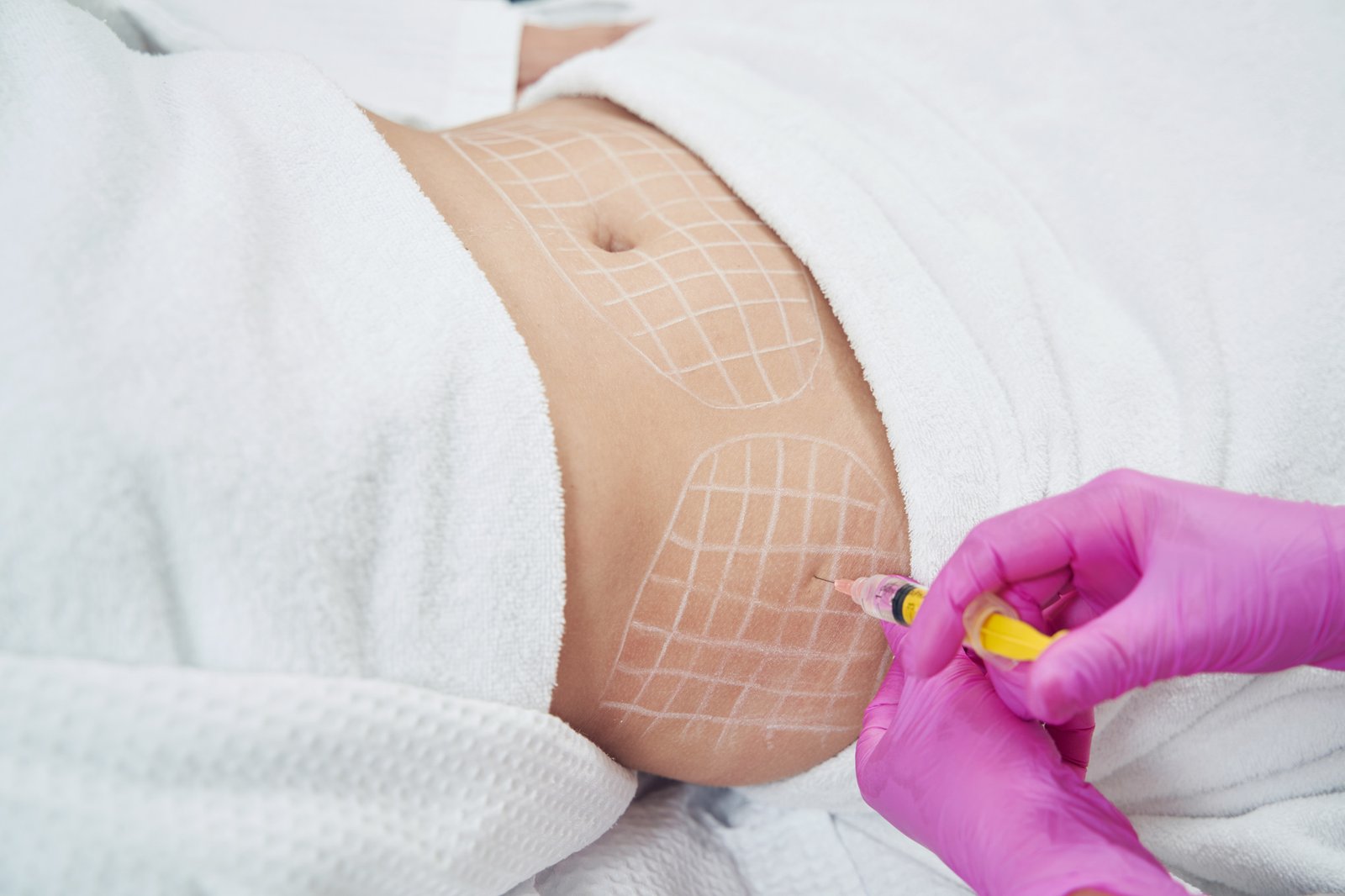 Is Fat Melting Injections Suitable for Weight Loss or Toning?