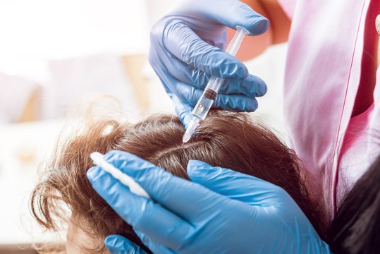 حقن البلازما للشعر في الرياض
