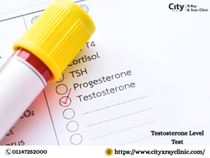 testosterone level test price