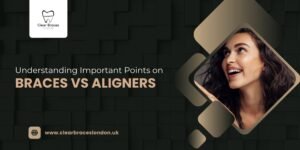 Understanding Important Points on Braces vs Aligners