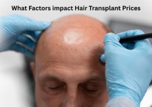 What Factors impact Hair Transplant Prices